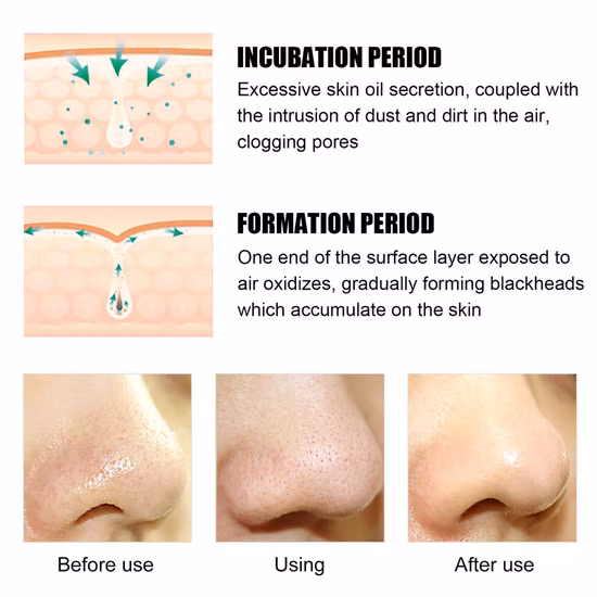 Atacado Natural Feito à Mão Orgânico Preto Bambu Carvão Sabão Limpeza Clareamento Rosto e Corpo Banho Bar Hotel e Casa EVA Flor Tailândia Sabonete Beleza Pele